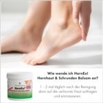 200ml Hornhautbalsam Urea 25 für Schrunden & trockene Fersen – Hornex