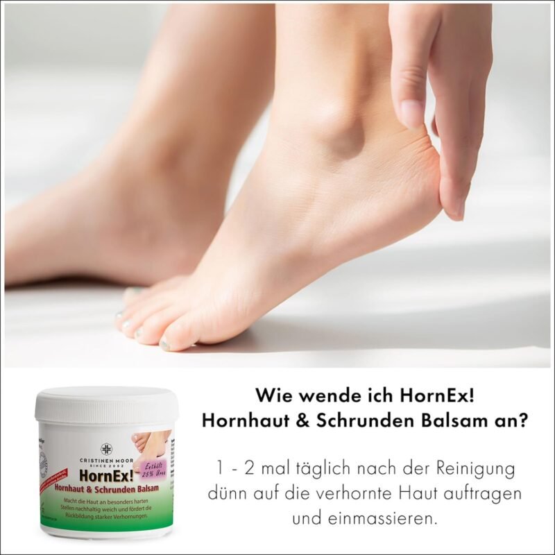 200ml Hornhautbalsam Urea 25 für Schrunden & trockene Fersen – Hornex