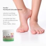 200ml Hornhautbalsam Urea 25 für Schrunden & trockene Fersen – Hornex